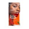 ABSOLUTE NEW YORK ACNE PATCH SPOT COVER 36 PCS
